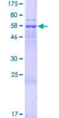 12.5% SDS-PAGE Stained with Coomassie Blue.