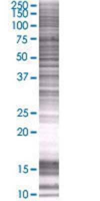 DHRS7 transfected lysate.