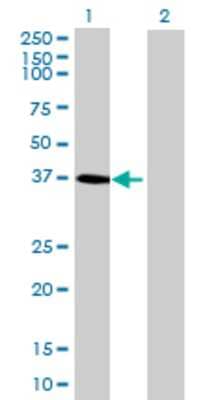 Lane 1: DHRS7 transfected lysate (37.4 KDa) Lane 2: Non-transfected lysate.