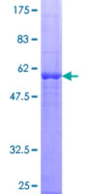 SDS-PAGE Recombinant Human Dexras1 GST (N-Term) Protein