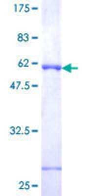 12.5% SDS-PAGE Stained with Coomassie Blue.