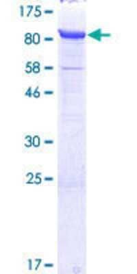 12.5% SDS-PAGE Stained with Coomassie Blue.