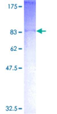 12.5% SDS-PAGE Stained with Coomassie Blue.