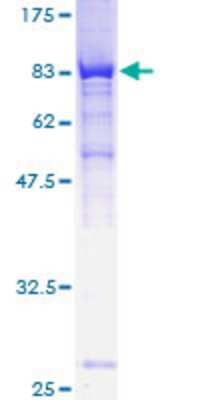 12.5% SDS-PAGE Stained with Coomassie Blue.