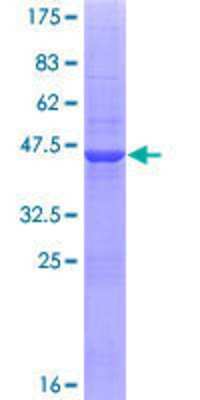 Other Recombinant Human ZNF44 GST (N-Term) Protein
