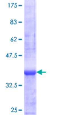 SDS-Page: Recombinant Human ZNF44 Protein [H00051710-Q01] - 12.5% SDS-PAGE Stained with Coomassie Blue.