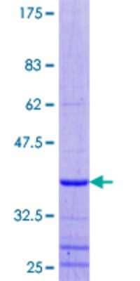 12.5% SDS-PAGE Stained with Coomassie Blue.