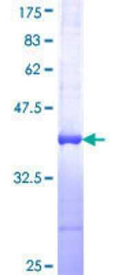 12.5% SDS-PAGE Stained with Coomassie Blue.