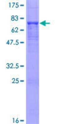 12.5% SDS-PAGE Stained with Coomassie Blue.