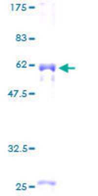 12.5% SDS-PAGE Stained with Coomassie Blue.