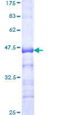 12.5% SDS-PAGE Stained with Coomassie Blue.