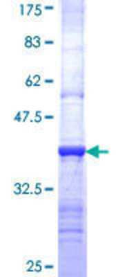 12.5% SDS-PAGE Stained with Coomassie Blue.