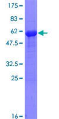 Other Recombinant Human Ctip1 GST (N-Term) Protein