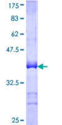 Other Recombinant Human Ctip1 GST (N-Term) Protein