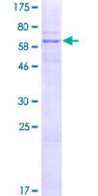 12.5% SDS-PAGE Stained with Coomassie Blue.