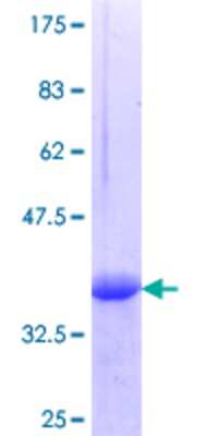 12.5% SDS-PAGE Stained with Coomassie Blue.