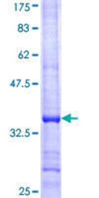 SDS-Page: Recombinant Human TRIM34 Protein [H00053840-Q01] - 12.5% SDS-PAGE Stained with Coomassie Blue.