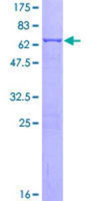 12.5% SDS-PAGE Stained with Coomassie Blue.