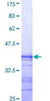 12.5% SDS-PAGE Stained with Coomassie Blue.