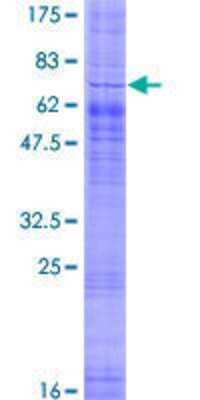 12.5% SDS-PAGE Stained with Coomassie Blue.