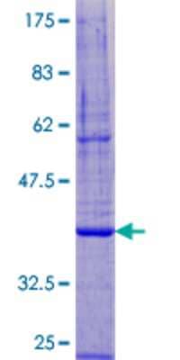 SDS-Page: Recombinant Human DPM3 Protein [H00054344-P01] - 12.5% SDS-PAGE Stained with Coomassie Blue.