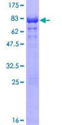 12.5% SDS-PAGE Stained with Coomassie Blue.