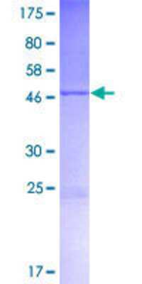 12.5% SDS-PAGE Stained with Coomassie Blue.