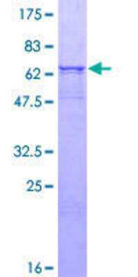 12.5% SDS-PAGE Stained with Coomassie Blue.