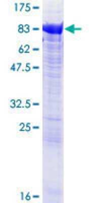 12.5% SDS-PAGE Stained with Coomassie Blue.