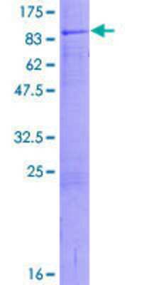 12.5% SDS-PAGE Stained with Coomassie Blue.