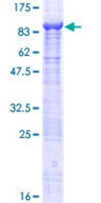 Other Recombinant Human PHD4/HIF Prolyl Hydroxylase 4 GST (N-Term) Protein