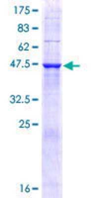 12.5% SDS-PAGE Stained with Coomassie Blue.