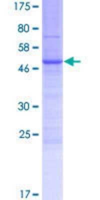 SDS-Page: Recombinant Human Ly6K Protein [H00054742-P01] - 12.5% SDS-PAGE Stained with Coomassie Blue.
