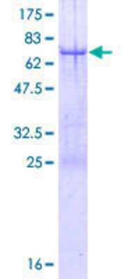 Other Recombinant Human TRIM44 GST (N-Term) Protein