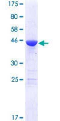 Recombinant Human MED18 GST (N-Term) Protein (H00054797-P01): Novus ...