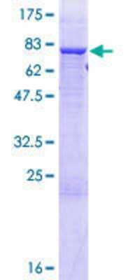 12.5% SDS-PAGE Stained with Coomassie Blue.