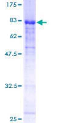 12.5% SDS-PAGE Stained with Coomassie Blue.