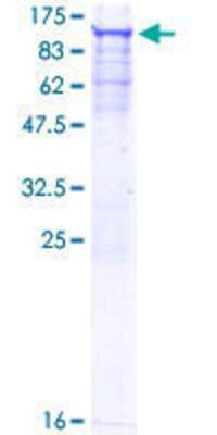 Other Recombinant Human SNRK GST (N-Term) Protein