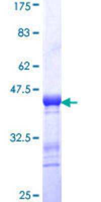 12.5% SDS-PAGE Stained with Coomassie Blue.