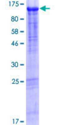 Other Recombinant Human QRICH1 GST (N-Term) Protein