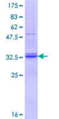 12.5% SDS-PAGE Stained with Coomassie Blue.