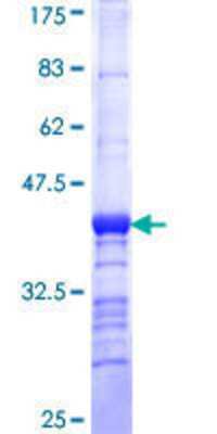 12.5% SDS-PAGE Stained with Coomassie Blue.