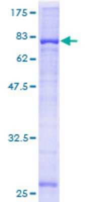 12.5% SDS-PAGE Stained with Coomassie Blue.