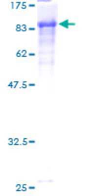 12.5% SDS-PAGE Stained with Coomassie Blue.