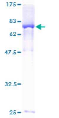 12.5% SDS-PAGE Stained with Coomassie Blue.