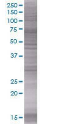 ZNF434 transfected lysate