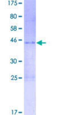12.5% SDS-PAGE Stained with Coomassie Blue.