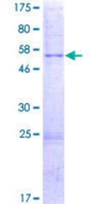 SDS-Page: Recombinant Human MRPL16 Protein [H00054948-P01] - 12.5% SDS-PAGE Stained with Coomassie Blue.