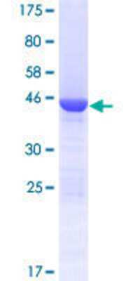 SDS-Page: Recombinant Human COMMD8 Protein [H00054951-P01] - 12.5% SDS-PAGE Stained with Coomassie Blue.
