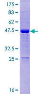 12.5% SDS-PAGE Stained with Coomassie Blue.